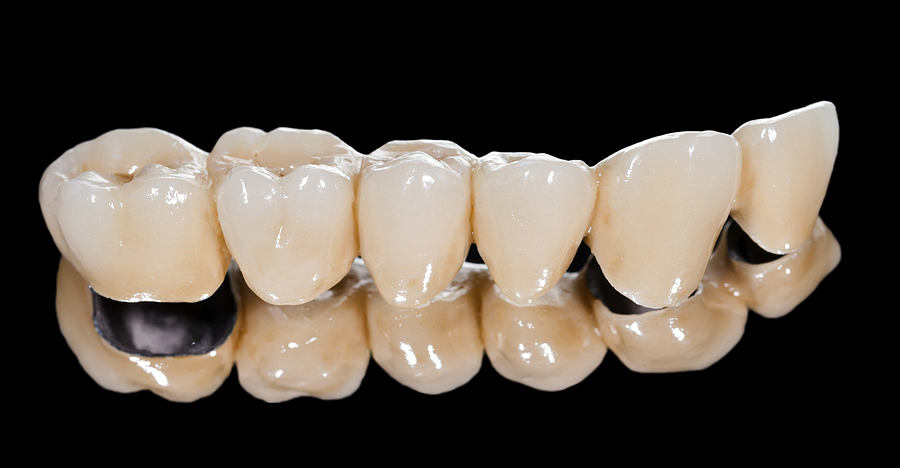 Restore Your Smile with Dental Bridges: Everything You Need to Know