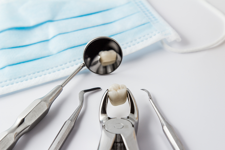 A Complete Guide to Tooth Extractions: What to Expect and How to Recover